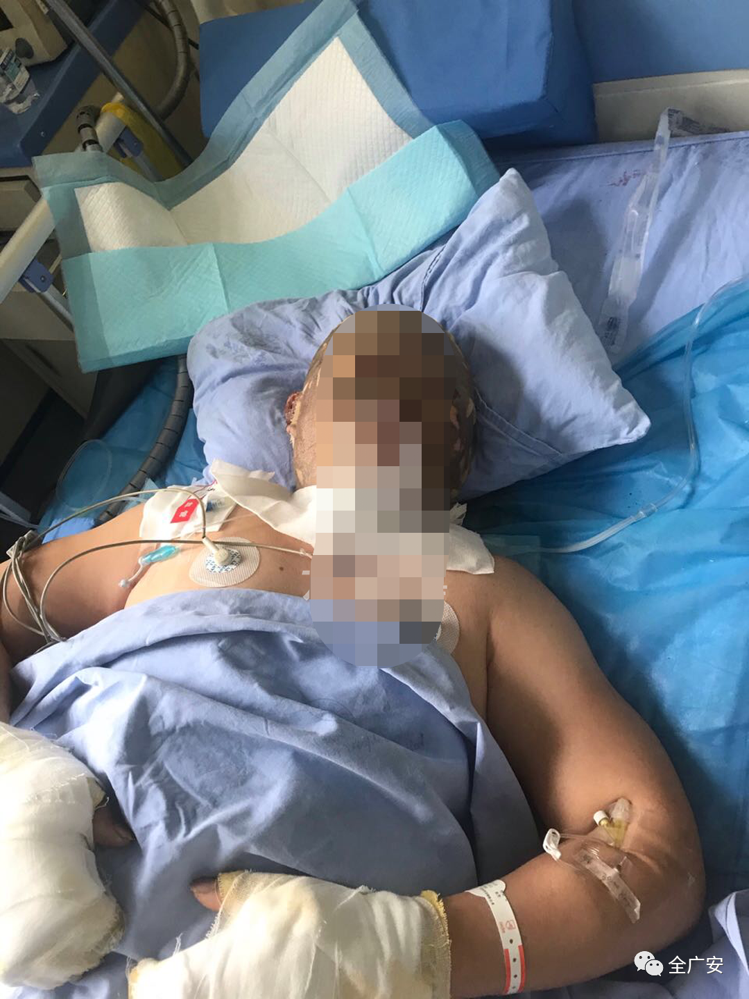 广安武胜一民房发生爆炸，5人受伤，疑似天然气泄漏